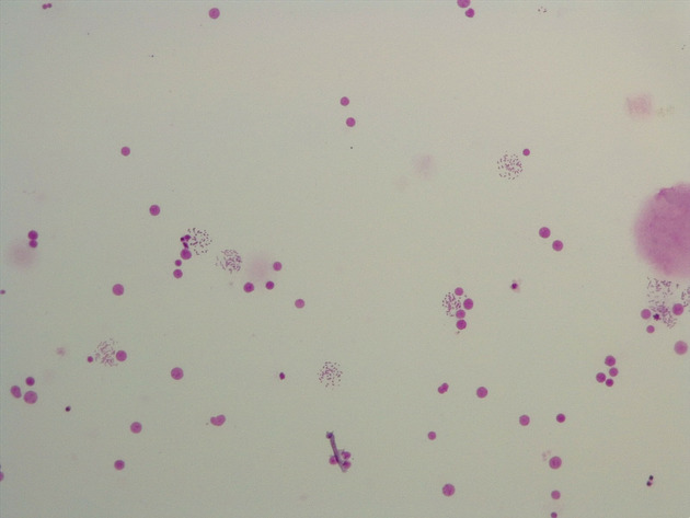 Female Chromosomes Slides - Female Chromosomes 04 100X